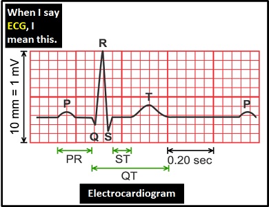 meaning of ECG