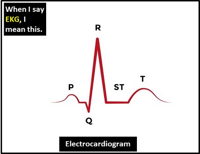 meaning of EKG